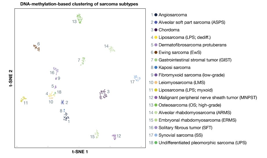 Diversity of sarcomas as highlighted by DNA methylation profiling.