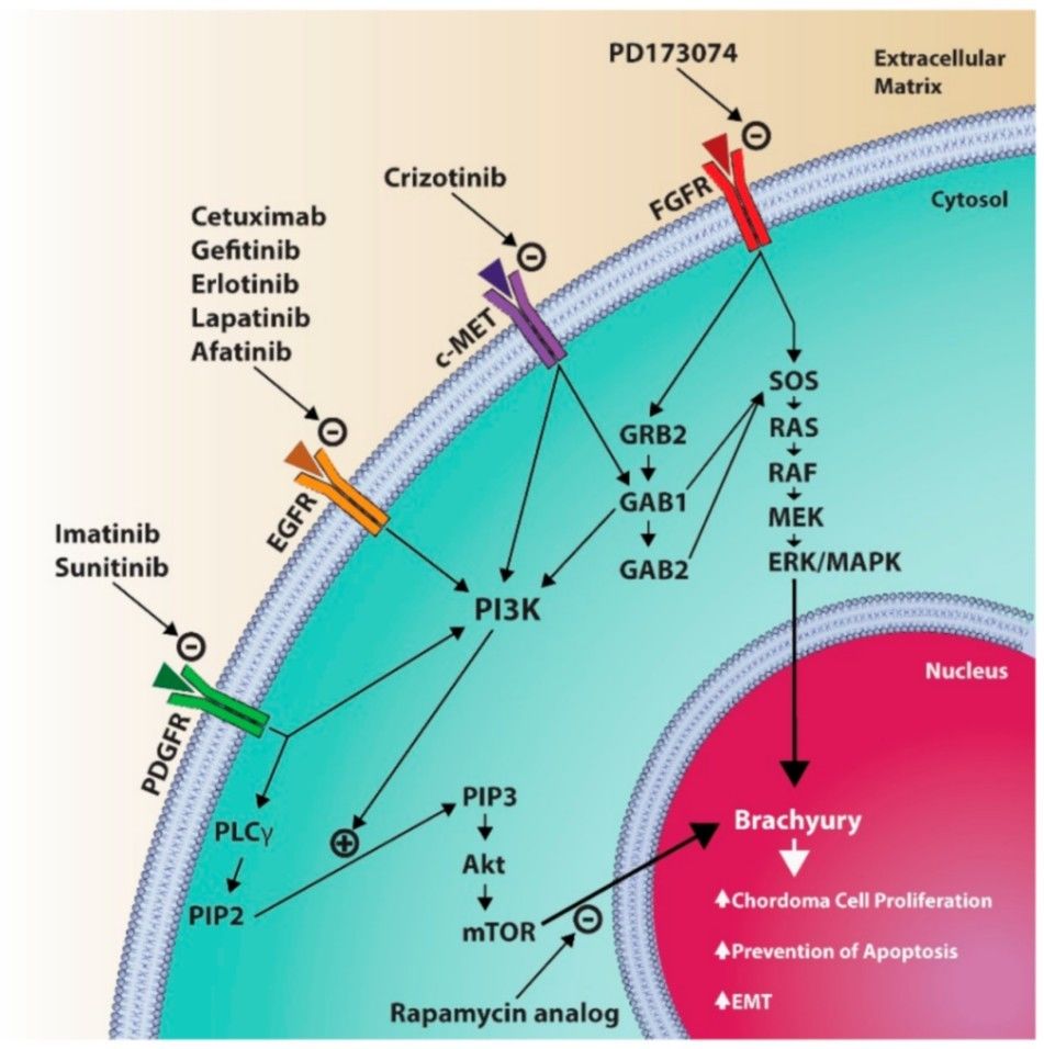 Diagram presenting some of the molecular pathways associated with chordoma pathophysiology.