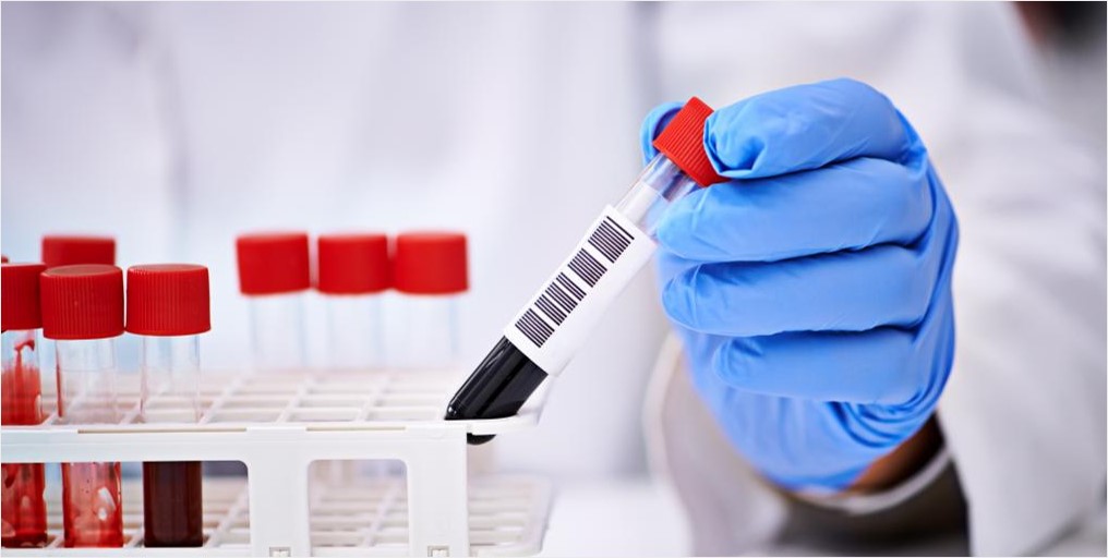 Biofluids