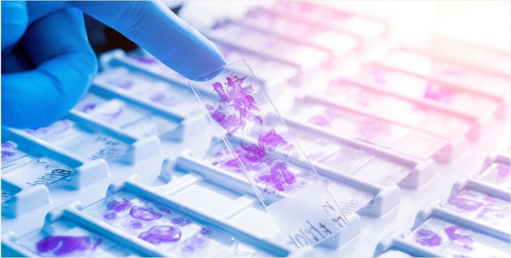 Cancer Tissue Samples