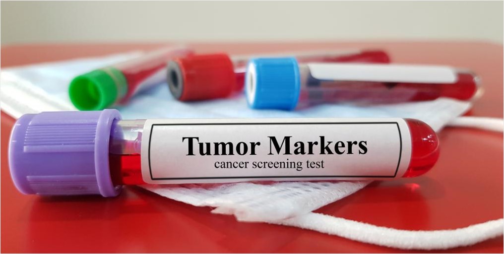 Cancer Biomarkers