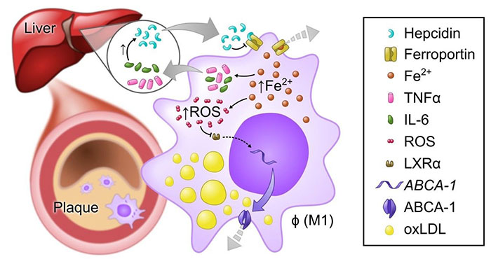 Hepcidin's role in foam cell formation and atherosclerosis pathogenesis. 