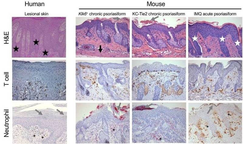 Human lesional vs. mouse psoriasiform skin in psoriasis.