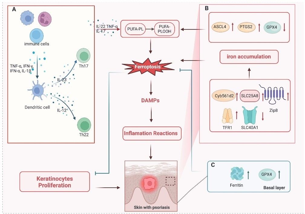 Ferroptosis mechanisms in psoriasis.