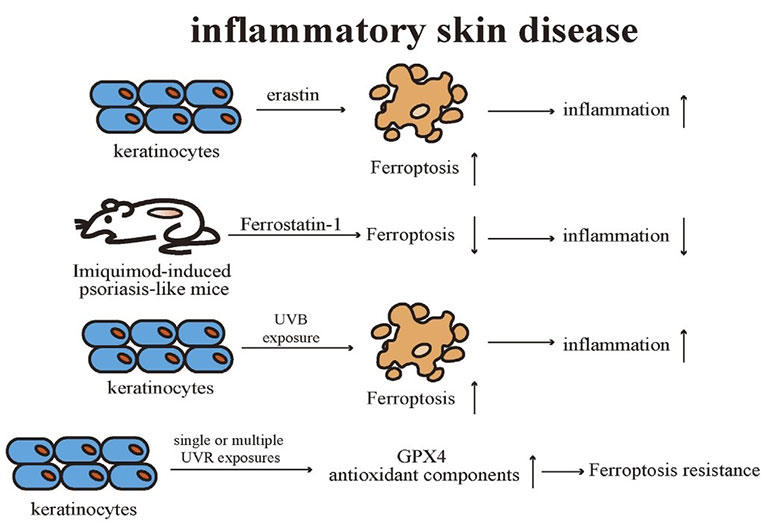 Ferroptosis in keratinocytes promotes proinflammatory cytokine release.