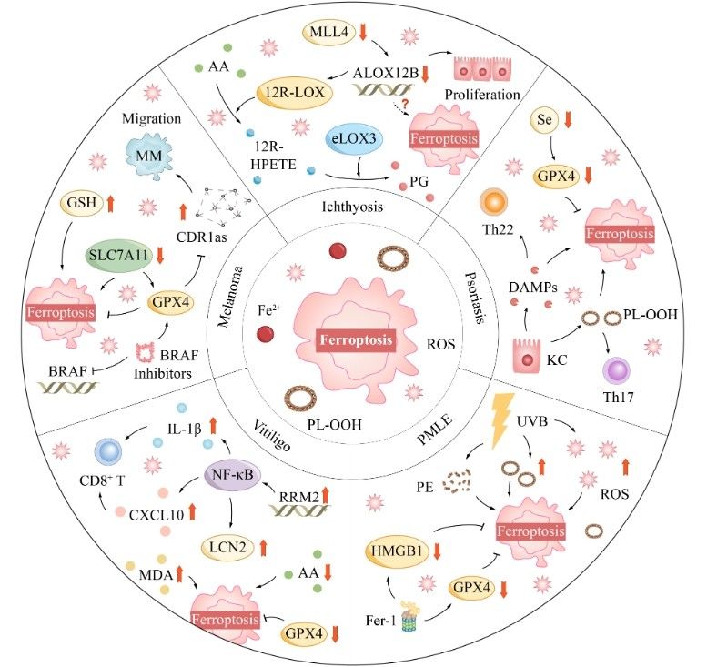 Ferroptosis is implicated in various skin diseases.