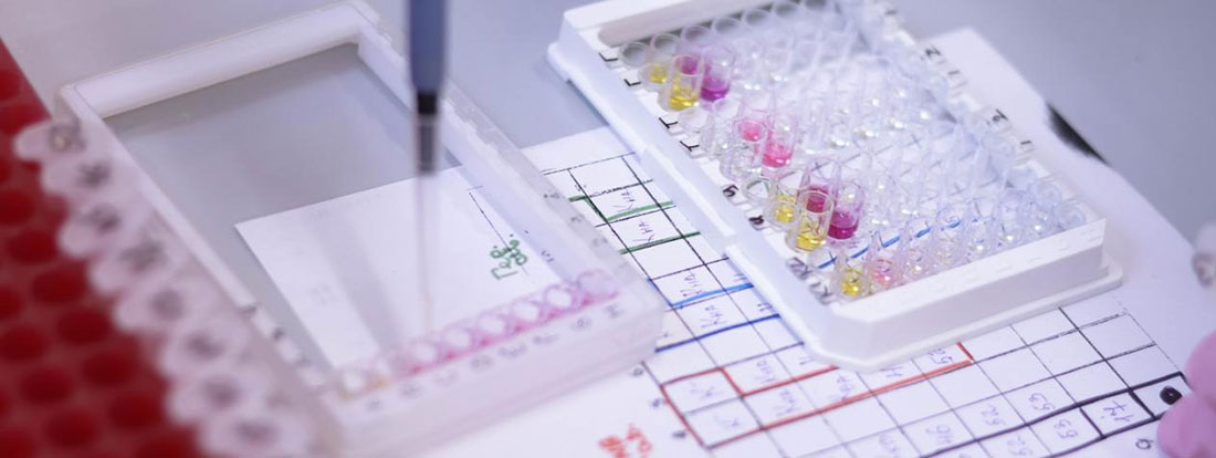 Iron metabolism assay kits.